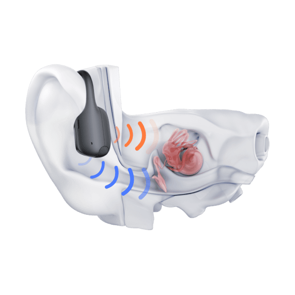 Tai nghe Bluetooth thể thao Shokz OpenRun Pro 2 - ảnh 7